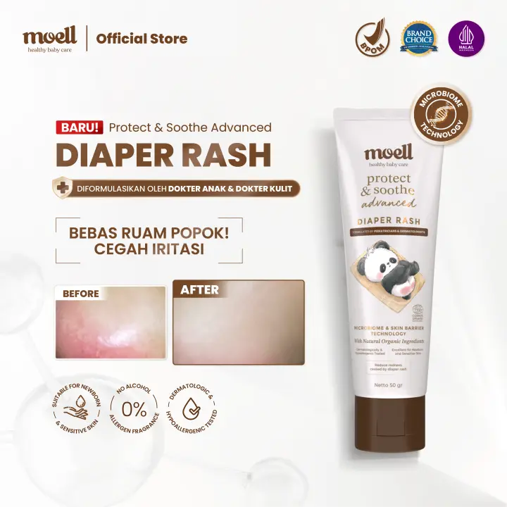 Moell Diaper Rash 50 gr